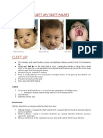 Cleft Lip and Palate Guide