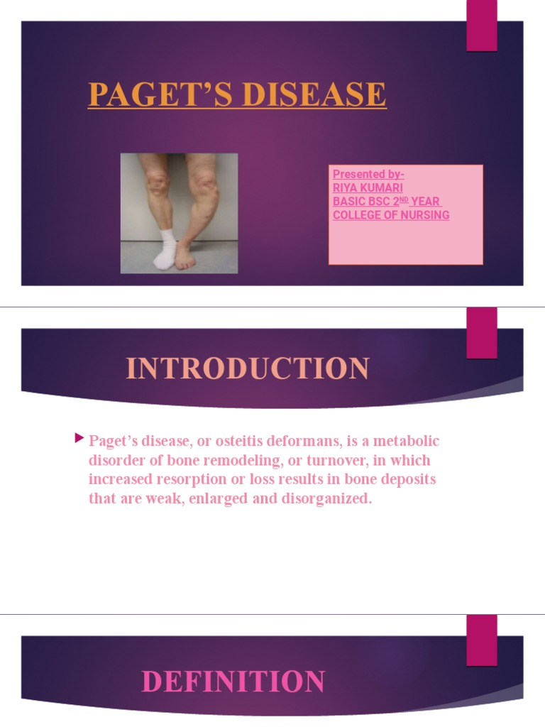 Nursing Management of Paget's Disease | PDF | Bone | Clinical Medicine