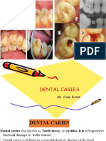 Dental Carries