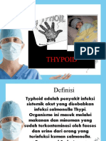 thypoid