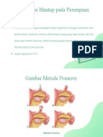 Metode Pomeroy