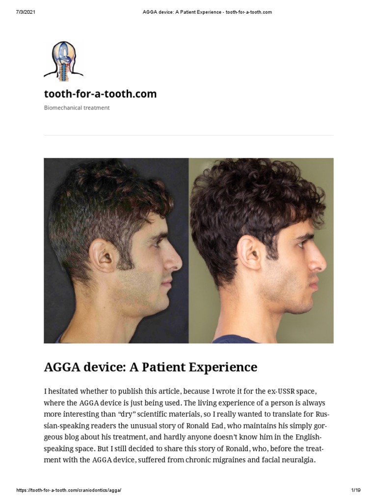 AGGA Device - A Patient Experience | PDF | Headache | Skull