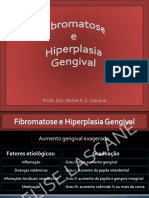 FibromatoseeHiperplasiagengivala449233