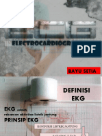 EKG