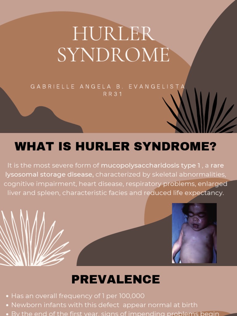 Hurler Syndrome - Evangelista | PDF | Medical Genetics | Genetic Disorder
