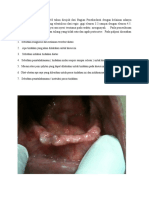 Soal OSCE - Bedah Mulut Alveolektomi
