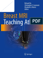 Breast MRI