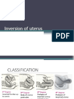 Inversion of Uterus