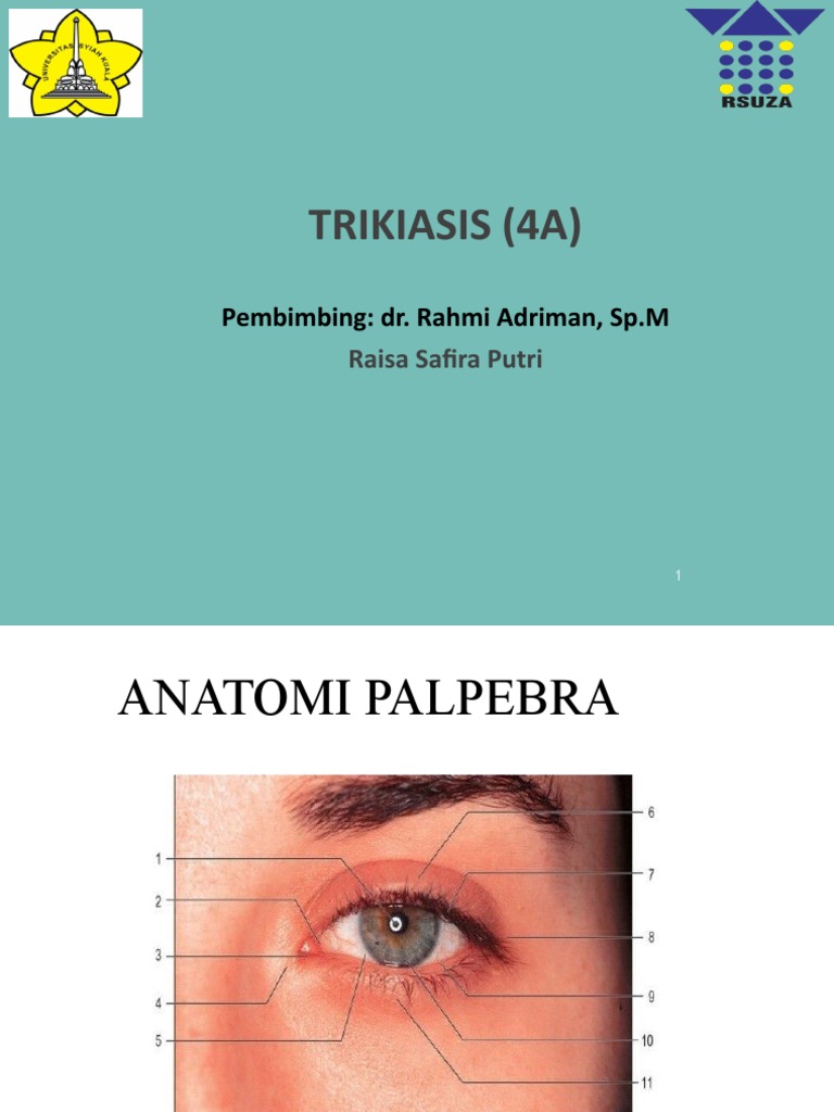 Trikiasis | PDF