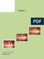 Sheet 2 (Gingiva 2)