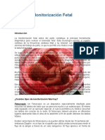 Monitorización Fetal