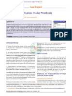 Fabrication of A Custom Ocular Prosthesis: Case Report