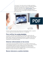 Muchos Piensan Que Los Rayos X Son Sólo Una Luz Invisible Que Pasa A Través de La Boca y Se Proyecta en Un Sensor