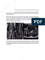 23.2 Hernia Discal