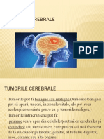 tumori cerebrale