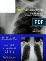 Pulmonary TB Investigation