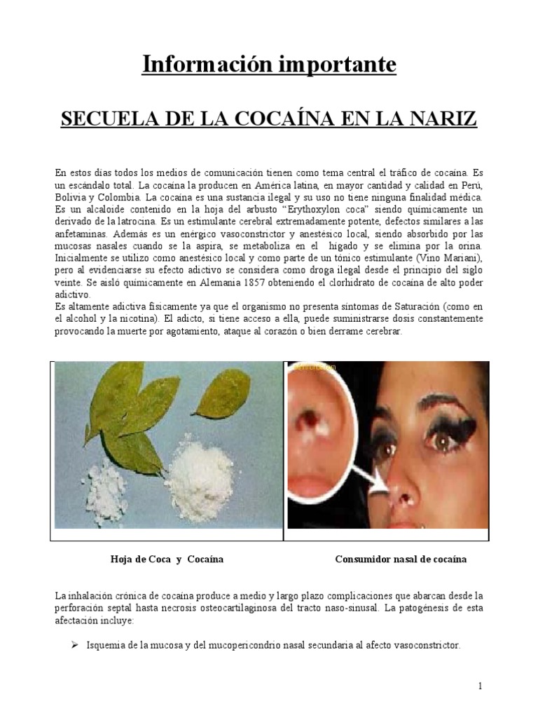 Informaci n Importante Secuela De La Coca na En La Nariz