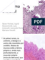 Carcinoma Urotelial01