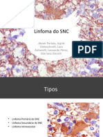 Linfoma Do SNC01