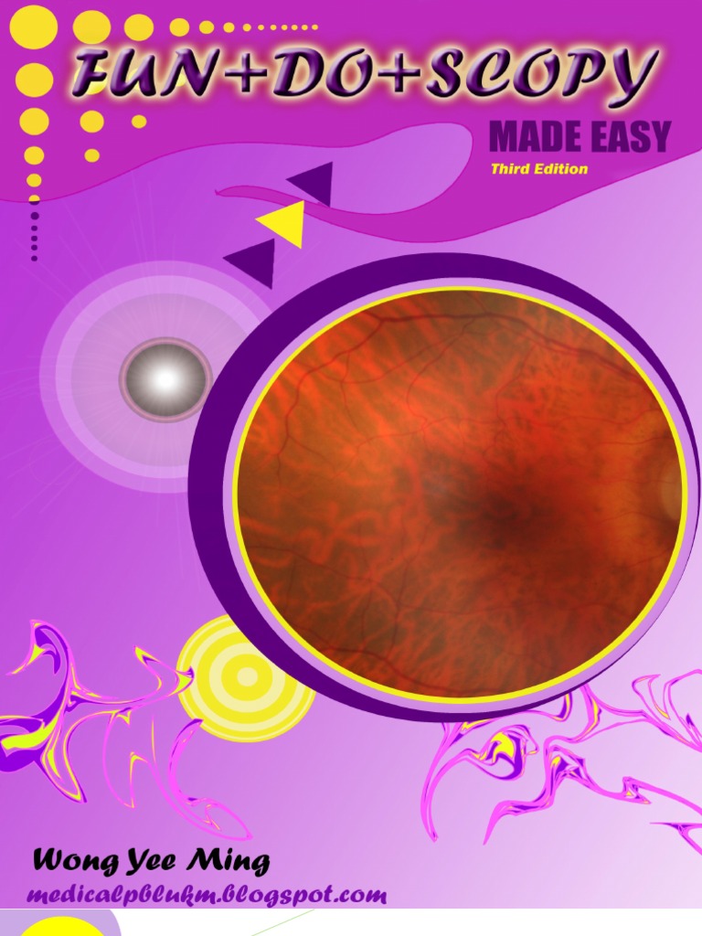 Fundoscopy Made Easy 3ed PDF Retina Diseases Of The Eye And Adnexa