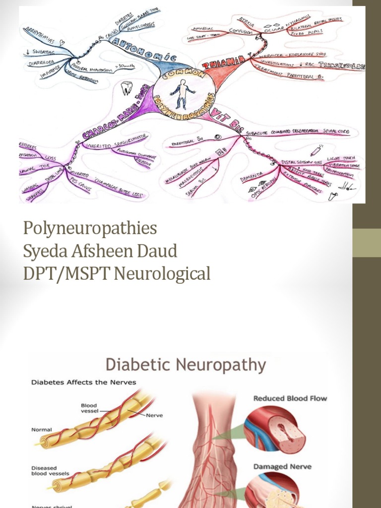 Understanding Peripheral Neuropathies | PDF | Peripheral Neuropathy ...