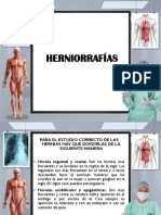 Guía completa sobre tipos de hernias y su corrección quirúrgica