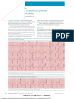 A Patient With a Paced Rhythm Presenting With Chest Pain and Hypotension.en.Es (1)