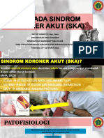 Ekg Sindrom Koroner Akut