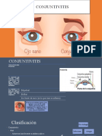 conjuntivitis