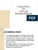 Case-Study ON Ocular Toxoplasmosis