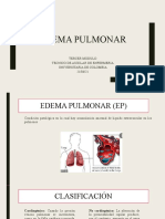 Sesión5-Edema Pulmonar