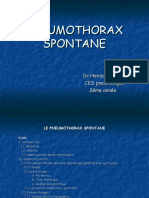 cupdf.com_pneumothorax-spontane-55849a169d557