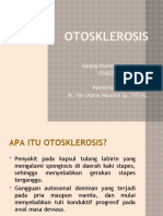 OTOSKLEROSIS