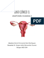 Caso clínico de mujer con miomatosis uterina