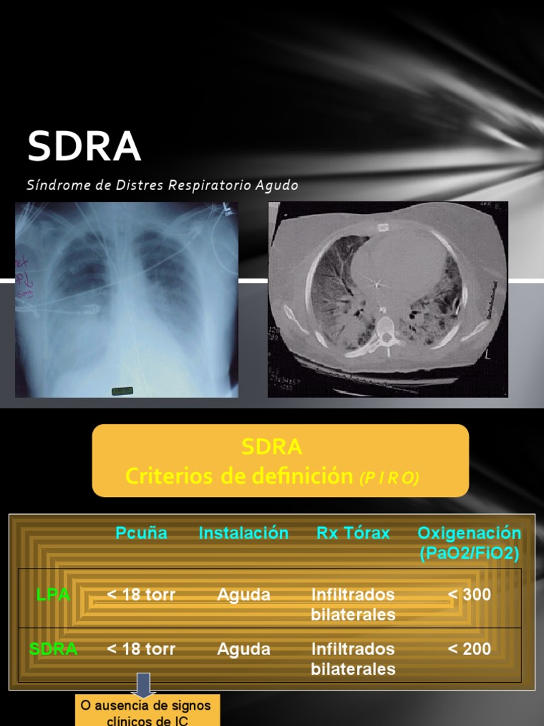 Sdra Clase Facultad | PDF | Enfermedades y trastornos humanos ...