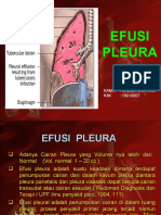 Dokumen_tips_efusi_pleura_power_point