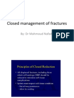 Closed Management of Fractures