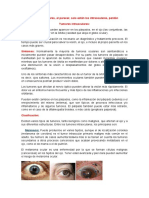 Tumores Intraoculares