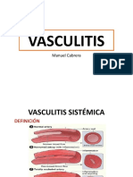 Vasculitis