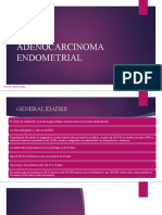 Adenocarcinoma Endometrial