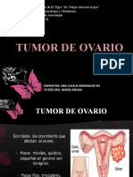 Tumor de Ovario