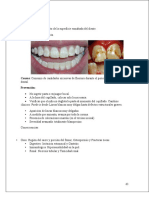 Fluorosis Dental Resumen