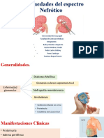 Sindrome Nefrotico - Grupo 2 - Subgrupo 5