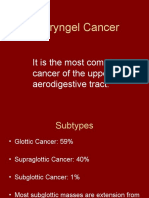 Laryngel Cancer: It Is The Most Common Cancer of The Upper Aerodigestive Tract