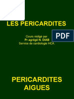 péricardite