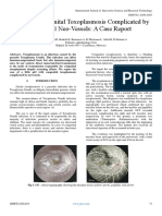 Bilateral Congenital Toxoplasmosis Complicated by Choroidal Neo-Vessels A Case Report