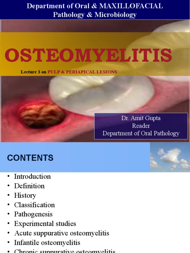 Understanding the Pathogenesis and Classification of Odontogenic