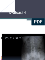 Evaluasi 4