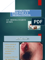 PERFORACIÓN ESOFAGICA CON O SIN MEDIASTINITIS