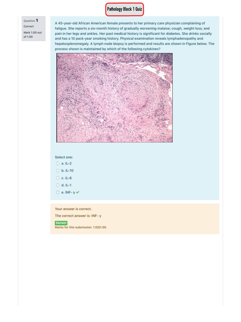 HPE2-B02認証pdf資料